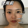 美美的天空積雪草面膜深度補(bǔ)水保濕提亮膚色曬后修復(fù)抗皺緊致敏感肌男女士 積雪草補(bǔ)水面膜1盒【共10片】 曬單實(shí)拍圖