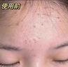 韓方五谷蘆薈膠舒緩凝膠面霜曬后修護(hù)褪紅補水保濕祛痘淡化疤痕乳液男女士 曬單實拍圖