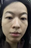 淚溝填充神器修復(fù)法令紋去除眼袋眼窩臉部凹陷填充膠原蛋白精華液 單盒裝 曬單實(shí)拍圖