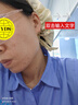 益膚醫(yī)用面膜透明質(zhì)酸 微創(chuàng)術(shù)后損傷修復(fù)緩解泛紅皮炎濕疹痤瘡6片 曬單實拍圖