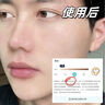 同仁堂美白淡斑霜去斑去黑色素去雀斑黃褐斑曬斑男女士專用醫(yī)用正品中藥 第2瓶半價(jià)【去除99%頑固斑點(diǎn)】 曬單實(shí)拍圖