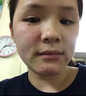 茉博士香港大藥房去痣點(diǎn)痣膏藥水臉部不留疤黑痣無(wú)痛修復(fù)液 曬單實(shí)拍圖