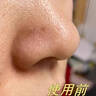 維特絲（vetes）去角質(zhì)面部啫喱控油保濕洗面奶男女士清潔毛孔黑頭閉口溫和不刺激 【6大專利】果酸去角質(zhì)啫喱200g 曬單實拍圖