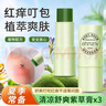 ehmznv紫草膏舒爽膏夏日清涼舒爽蚊蟲子叮咬呵護(hù)保濕肌膚腫包清涼膏潤(rùn)膚 8g 3支 植萃舒癢紫草膏 曬單實(shí)拍圖