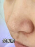 韓紀(jì)去黑頭導(dǎo)出液收縮毛孔深層清潔套裝去黑頭清理神器吸黑頭官方正品 1盒裝【去黑頭導(dǎo)出液】 曬單實(shí)拍圖