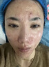 醫(yī)用痤瘡中藥去青春痘粉刺紅腫硬疙瘩痘印祛痘痘消炎痤瘡膿皰瘡去痘印青少年專用清熱暗瘡?fù)琛疽曈X特效】 3盒【療程裝】 曬單實(shí)拍圖