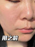 維特絲面膜美白補水保濕淡斑男女士去黃氣提亮膚色暗沉緊致抗皺熬夜修復 曬單實拍圖