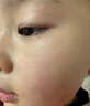 華美科醫(yī)用重組人體表皮生長因子點(diǎn)痣疤痕修復(fù)凝膠燙軟膏傷口愈合15g1支 曬單實(shí)拍圖