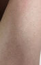 腿部毛囊炎大腿毛囊炎腿上紅疙瘩瘙癢藥膏大小腿長疙瘩膿包毛囊炎角化雞皮膚搭專用噴霧藥膏 單盒體驗裝 曬單實拍圖