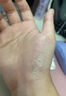 汗皰疹濕疹止癢手起水泡癢脫皮干手止癢皮膚瘙癢真菌感染抑菌膏藥 一盒【無(wú)效全額秒退】 手上起水泡癢用什么 曬單實(shí)拍圖