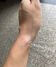 白貓 醫(yī)用型腱鞘炎護(hù)腕大拇指手腕關(guān)節(jié)固定支具手腕護(hù)具鋁板支撐固定 曬單實(shí)拍圖