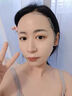 阿杰魯醫(yī)用冷敷貼保濕補水退熱敏感肌專用面膜型美容院同款械字號 一盒5片【補水+保濕】 曬單實拍圖