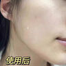 后美博士爆款氨基酸潔面乳控油祛痘深層清潔溫和保濕男女通用洗面奶 氨基酸潔面乳100g*1 曬單實(shí)拍圖