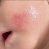 Masata新加坡進(jìn)口水膏嬰兒唇周膏新生兒護(hù)理膏嘴部疹寶寶嬰幼兒專用20g 曬單實(shí)拍圖