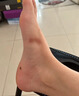 達(dá)克寧腳氣藥止癢脫皮爛腳丫真菌感染治療腳氣特專用效藥腳氣藥止癢脫皮爛腳丫抗真菌感染根專硝酸咪康唑乳膏 1盒【達(dá)克寧治腳氣】 曬單實(shí)拍圖