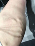 葆元醫(yī)生靜脈曲張冷敷凝膠紅血絲腿部青筋凸起蚯蚓腿腫脹藥膏 3盒裝【性價比高 80%用戶選擇】大多情況都適用 曬單實拍圖