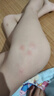 安貝兒叮叮天然精油多效護理膏寶寶止癢膏防護香膏兒童紫草膏 多效護理膏25g【細口方便取量】 曬單實拍圖