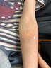 olioli疤痕貼醫(yī)用剖腹產(chǎn)雙眼皮增生凸起去祛除減張貼面部修復硅酮15*3cm 曬單實拍圖