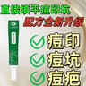 孩子去痘膏去痘印粉刺黑頭痘印消除紅腫痘痘修復男女祛痘印凝膠清 坑痘印黑頭粉刺消除紅腫痘 1支 曬單實拍圖