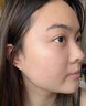 維特絲壬二酸祛痘藥膏去痘痘粉刺閉口收縮毛孔男女煙酰胺水楊酸 曬單實拍圖