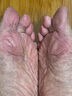 BEAI皸裂腳裂膏腳后跟防干裂皸裂龜裂開(kāi)裂凍裂膏護(hù)手足干裂潤(rùn)膚霜 曬單實(shí)拍圖
