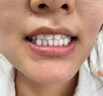 維特絲美亮白牙膏口臭去黃去牙漬去煙漬牙垢護(hù)齦清新口氣熱銷金榜第一名 曬單實(shí)拍圖