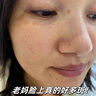 白云山377煙酰胺面霜美白祛斑霜淡化黑色素去老黃斑雀斑補(bǔ)水保濕30g 曬單實(shí)拍圖