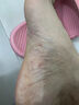 香港大藥房真菌王抑菌止癢膏真菌腳氣感染腳臭腳后跟開裂干裂脫皮膚膏官方 1盒【見效裝】 曬單實(shí)拍圖