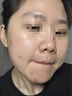 盧曼博士 DR.LUMANdr.luman盧曼博士三件套經(jīng)典版油痘肌混油皮面部護(hù)理護(hù)膚套裝正品 盧曼博士2號(hào)祛痘精華液40ml 曬單實(shí)拍圖