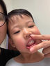 巴貝奇  BABBAGE防咬下嘴唇矯正神器牙套糾正小孩地包天牙齒矯正牽引器兒童6-12歲 兒童初期【偏軟】不自覺咬下唇 曬單實(shí)拍圖