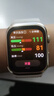 華為（HUAWEI）WATCH D2智能手表 血氧血壓心率運動通話情緒長續(xù)航新款系統(tǒng) 海外國際港版 金色（港版） 曬單實拍圖