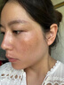 郝愛妮美白祛斑霜淡化黑色素去雀斑黃褐斑祛斑美白提亮去黃改善暗沉膚色 曬單實(shí)拍圖