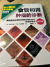 食管和胃腫瘤的診斷 曬單實拍圖