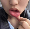 蓬仁藥業(yè)口腔潰瘍修復(fù)凝膠口腔潰瘍專用的藥口舌生瘡上火兒童可搭口腔潰瘍貼可搭口腔潰瘍散西瓜霜口腔潰瘍噴劑一點(diǎn)靈 曬單實(shí)拍圖