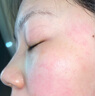 YDUNVIE易科美膠原點陣嫩膚美容儀抗皺縮毛孔淡痘痕 珍珠銀【七夕情人節(jié)禮物送女友送老婆】 曬單實拍圖