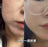 百洛娜防偽可溯源進(jìn)口居家水光精華原液補(bǔ)水淡斑保濕提亮去黑黃收縮毛孔 單支（歐泊動能素+美白水光） 曬單實拍圖