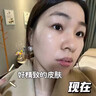 百靈鳥377美白祛斑霜祛斑美白淡化黑色素去雀斑老年黃褐斑男女士專用 曬單實拍圖