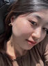 汗管瘤眼部去除油脂粒祛眼部周圍脂肪粒專用眼霜眼油脂粒涂抹藥膏 單盒裝 曬單實(shí)拍圖
