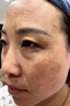 維a酸乳膏去老年斑專用藥一夜消祛斑點(diǎn)斑專用藥水去除老年斑特有效藥手臉部雀黃褐斑老人斑皮膚用藥 1盒裝【去老年斑男士專用藥除老年黑斑臉部手背】 曬單實(shí)拍圖