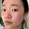醫妮姿醫用修復敷料醫美水光術(shù)后修護屏障舒緩泛紅敏感肌護理械字號 【買(mǎi)2贈1】醫用修護液 噴霧100ml 曬單實(shí)拍圖