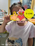olioli 祛疤膏兒童燙傷手術小孩專用修復去疤痕醫(yī)用硅酮凝膠敷料20g/支 曬單實拍圖