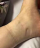 水腫消腫特新效藥利尿消水腫專用藥去水腫浮腫治腳背浮腫四肢水腫老人一按一個(gè)坑走路困難腎虛無力補(bǔ)益地黃丸 一盒裝【國藥準(zhǔn)字號(hào)】 曬單實(shí)拍圖