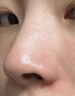 康佳（KONKA）吸黑頭清理神器去小氣泡黑頭毛孔粉刺清潔儀男女士臉面鼻部美容儀黑頭吸出器生日七夕禮物送男女友 曬單實拍圖