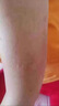 丹參酮膠囊祛痘消炎痤瘡專用藥青少年學(xué)生男女去痘痘和痘印抗菌消炎背上長痘痘藥毛囊炎青春痘紅腫粉刺膿包癤 1盒裝【痤瘡痘痘】 曬單實(shí)拍圖