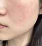 白云山藍(lán)銅肽凍干粉美白修復(fù)醫(yī)用保濕補(bǔ)水淡斑祛痘印痘坑修復(fù)收縮毛孔祛 一盒體驗裝 曬單實拍圖