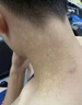 汗斑花斑癬除i根真菌感染汗斑凈噴劑皮膚癢止癢汗斑藥膏100%正品 1盒裝【一抹去除】特效膏 曬單實(shí)拍圖