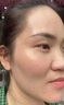 百靈鳥377美白祛斑霜祛斑美白淡化黑色素去雀斑老年黃褐斑男女士專用 曬單實拍圖