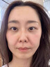 OHBT魚子醬抗皺面膜10片抗皺緊致抗衰老補水祛黃提亮膚色金榜第1名 曬單實拍圖