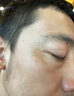 YYTISS377祛斑霜美白淡化老年黃褐雀斑黑色素曬淡斑精華醫(yī)I用煙酰胺凝膠 曬單實拍圖