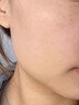 焦博士日本曬后修復面膜修復敏感皮膚屏障受損泛紅醫美用防曬傷急救白 曬單實(shí)拍圖